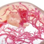 health care 3d printing anatomical models 3d printing patient-specific anatomical models in hospitals helps