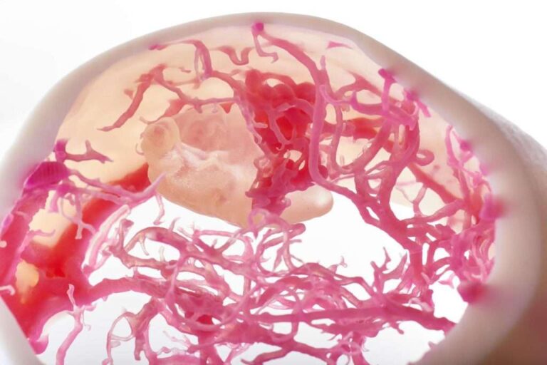 health care 3d printing anatomical models 3d printing patient-specific anatomical models in hospitals helps