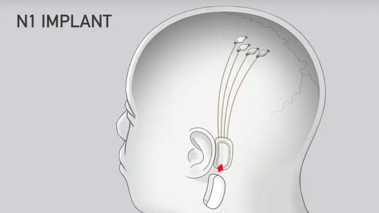 neuralink brain implant Neuralink day highlights a brain implant with over 4000 channels