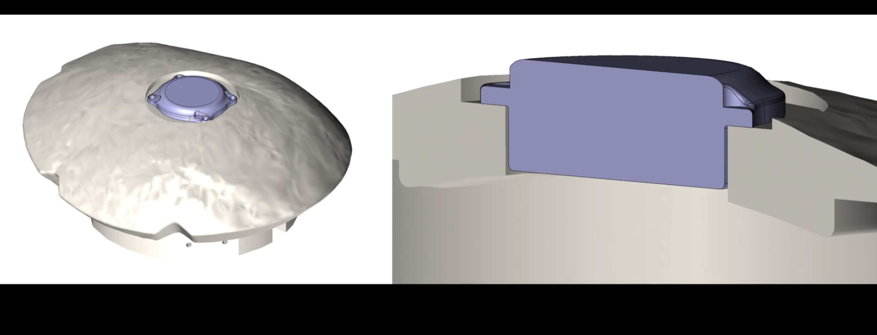 Here's How Neuralink Is Modifying Its Brain Chip for Second Human Patient