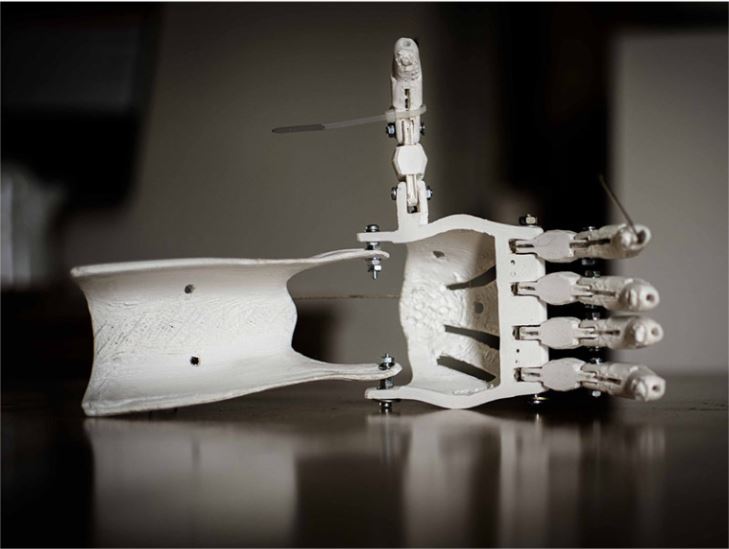 3D Printing in Health Care – Magnon3D