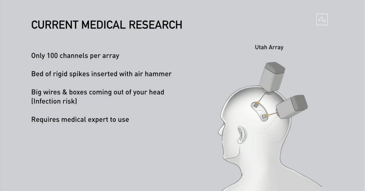 Elon Musk Debuts How Neuralink Device Works in Real-Time