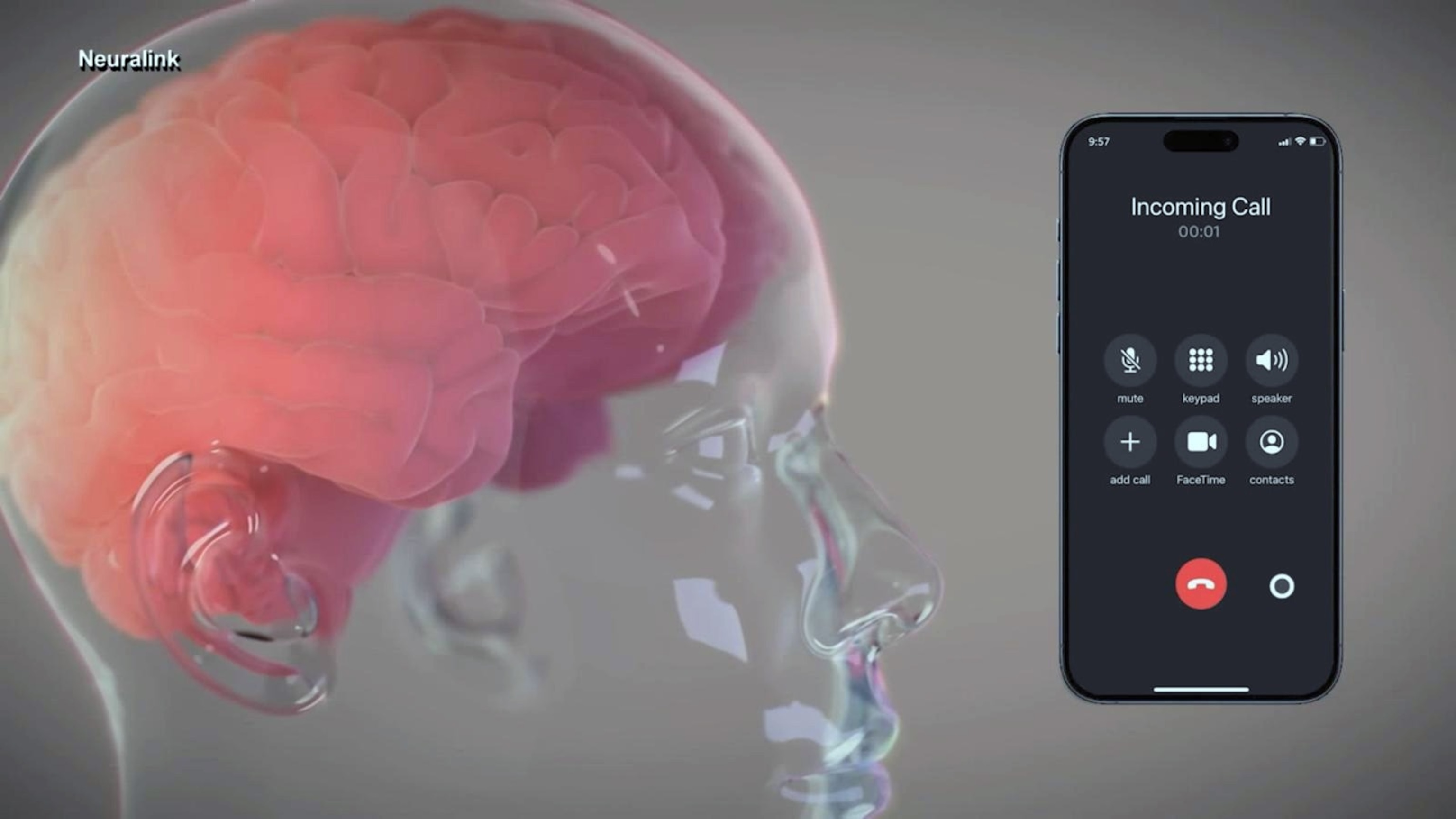 What to know about Elon Musk’s Neuralink brain chip implant - ABC News